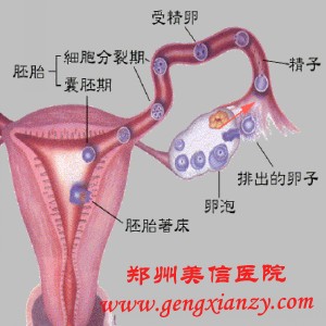 输卵管不通