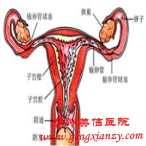 输卵管不通