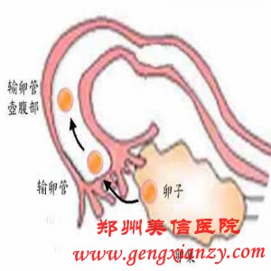 输卵管不通