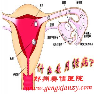 痛经