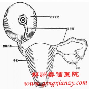 卵巢囊肿
