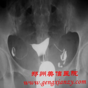 不孕不育