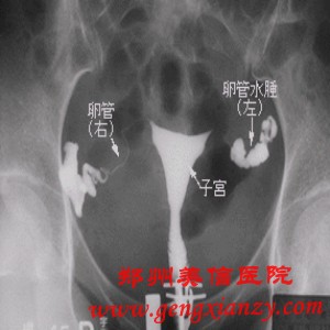 不孕不育