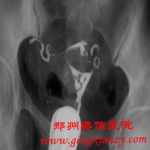不孕不育