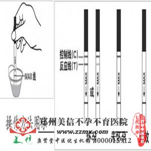 不孕不育医院