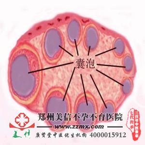 多囊卵巢